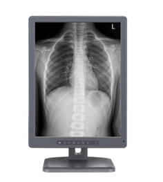 放射诊断显示器.png