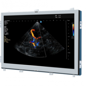 医用超声显示模组