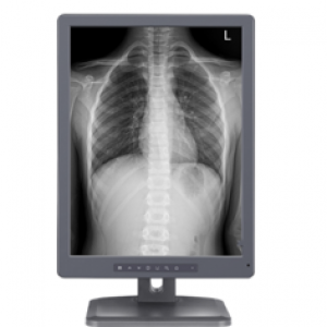 放射诊断显示器